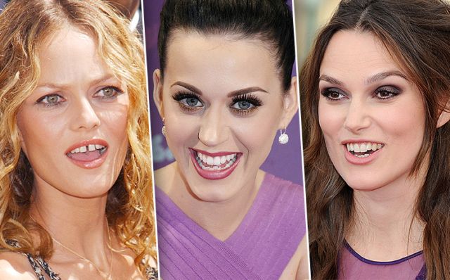 Неголливудская улыбка: 10 звезд, которые не стесняются своих некрасивых зубов