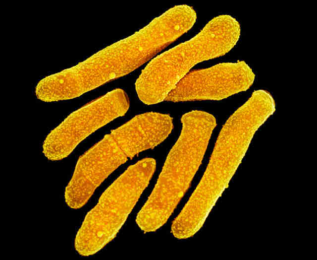 Propionibacterium Acnes 