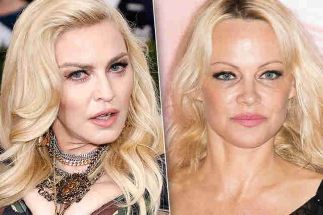 Слезли с иглы: Мадонна и другие звезды, отказавшиеся от инъекций ботокса