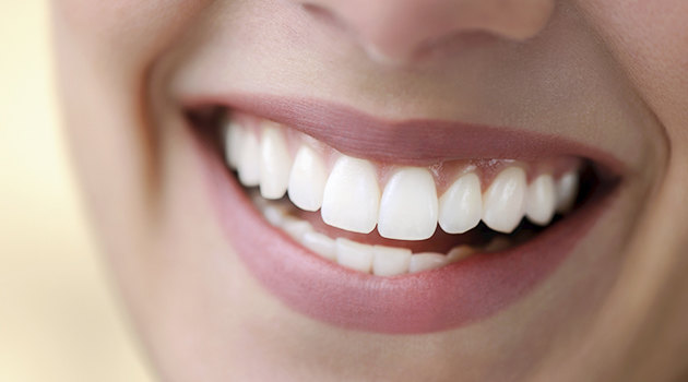 Все, что ты должна знать об отбеливании зубов