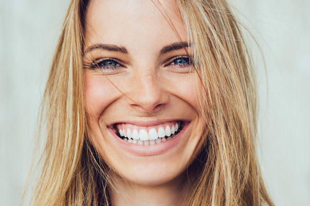 Без виниров: 4 способа сделать улыбку белоснежной